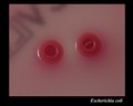 escherichia coli